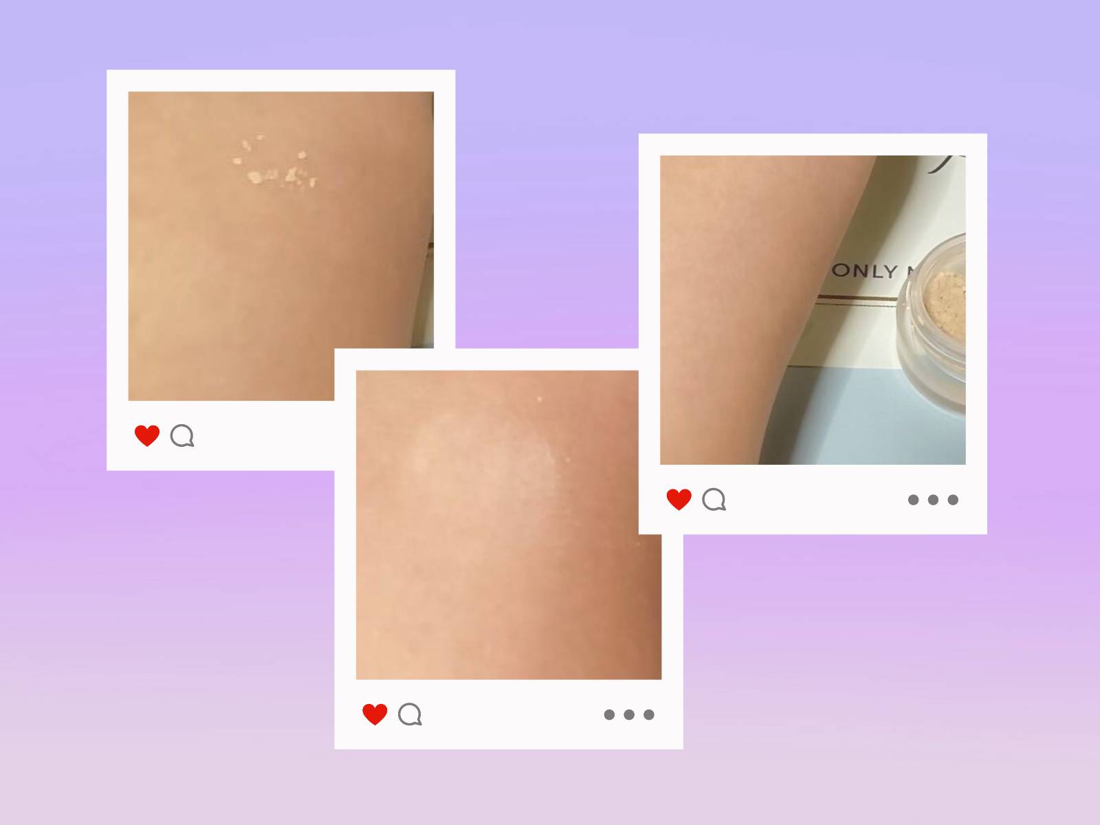 薬用コンシーラー アクネプロテクター/ONLY MINERALS/パウダーコンシーラーを使ったクチコミ（3枚目）