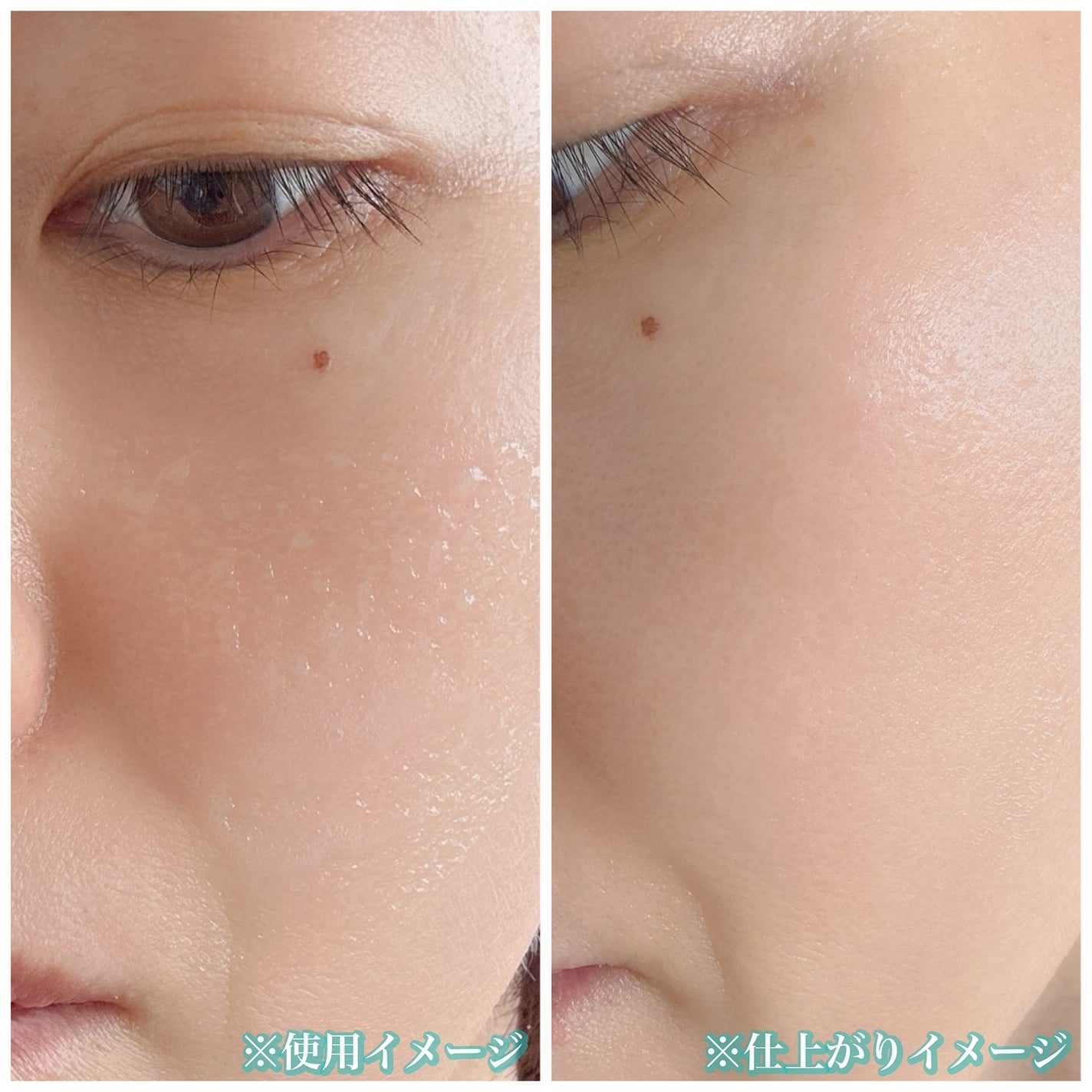 ソフィーナ iP 水光ピーリング泡セラム<ふきとり美容液>/SOFINA iP/美容液を使ったクチコミ(4枚目)