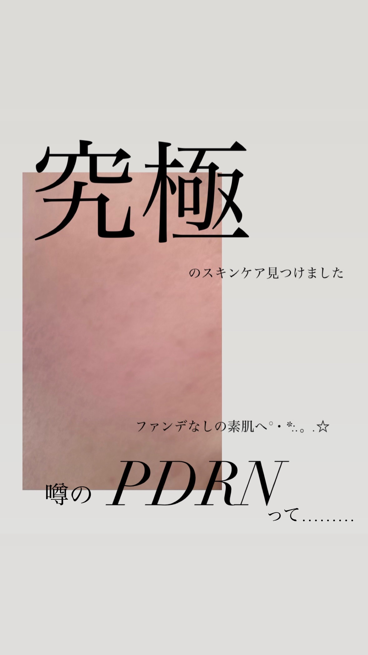 リードルショット300/VT/美容液を使ったクチコミ（1枚目）