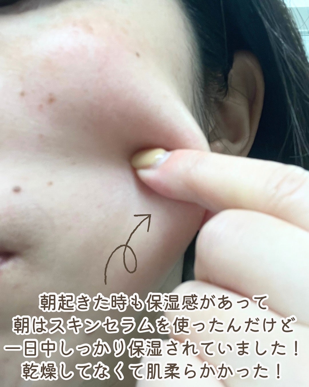 ari on LIPS 「・Carenology95様(@carenology95.jp..」(4枚目)