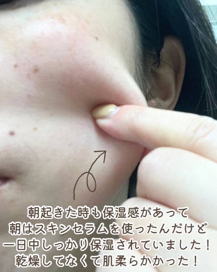 ari on LIPS 「・Carenology95様(@carenology95.jp..」(4枚目)