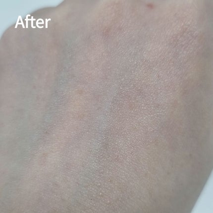 RXザ・アルファアルブチン2 ニキビ跡ケアセラム/COSRX/美容液を使ったクチコミ(5枚目)