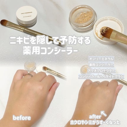 薬用コンシーラー アクネプロテクター/ONLY MINERALS/パウダーコンシーラーを使ったクチコミ(1枚目)