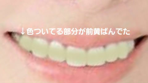 オクチレモン(マウスウォッシュ)/オクチシリーズ/マウスウォッシュ・スプレーを使ったクチコミ(3枚目)