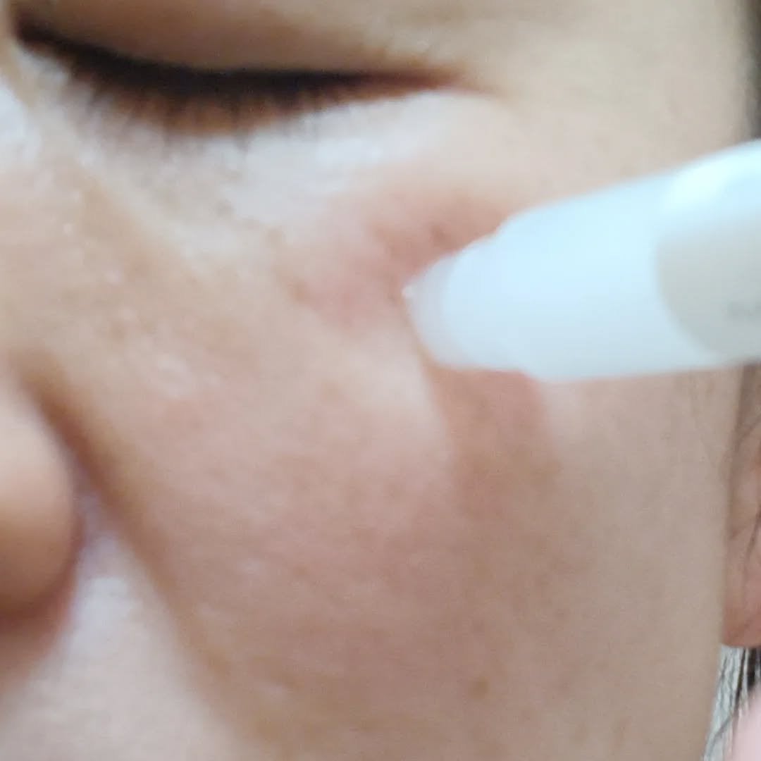 スポットノック WHITE/KIWAMI/美容液を使ったクチコミ(5枚目)