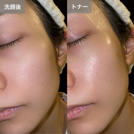 ダムトーン ポアトーンニングアキュエッセンス/ダムトーン/美容液を使ったクチコミ(6枚目)