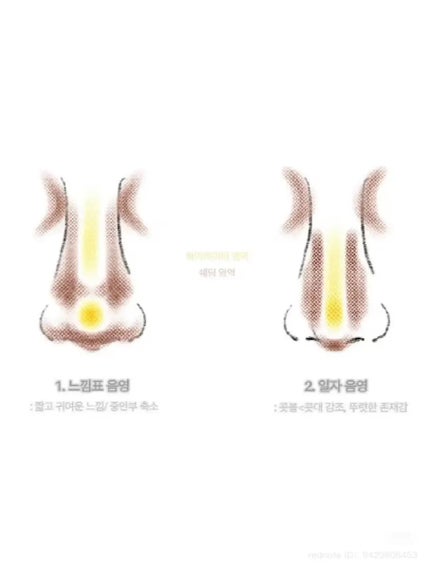 ã䜿ã£ãã¯ãã³ãïŒ1æç®ïŒ