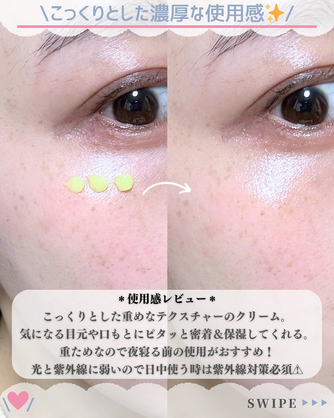 VITALIFT A forte/Dr.Different/フェイスクリームを使ったクチコミ(6枚目)