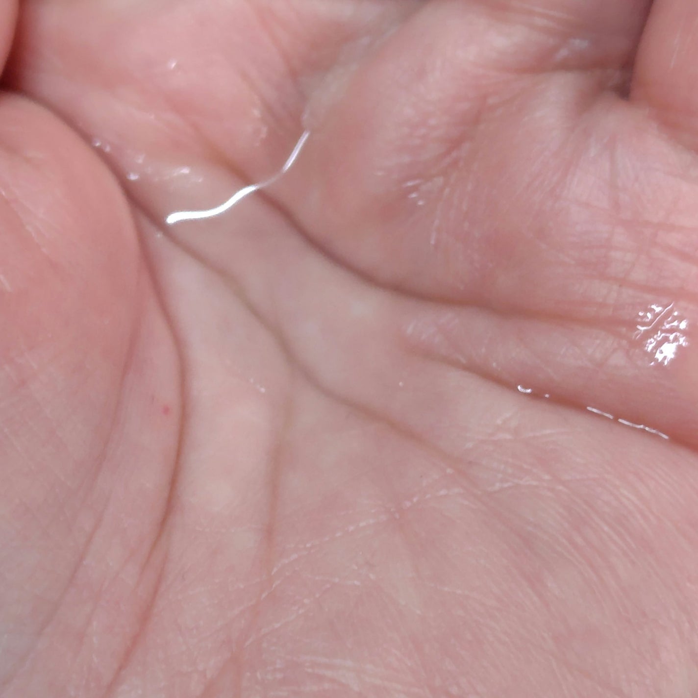 モイストバランス ローション/ACSEINE/化粧水を使ったクチコミ(2枚目)