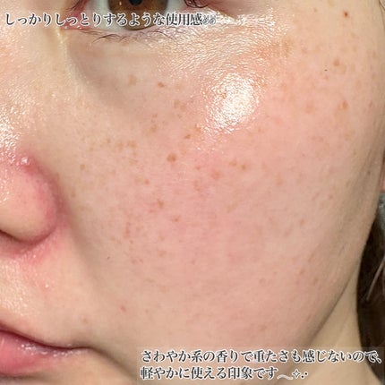 ナノインフィルトセラムLP/EXOLABEL/美容液を使ったクチコミ(4枚目)