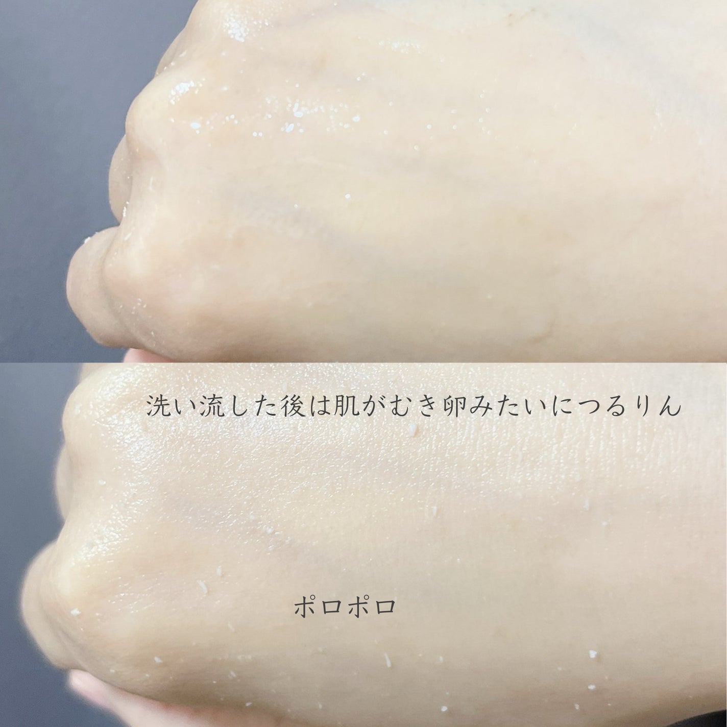 白米ピールショットゴマージュアンプル/Dr.Melaxin/美容液を使ったクチコミ(5枚目)