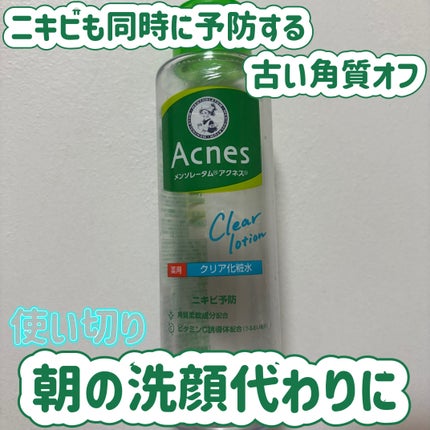 薬用クリア化粧水/メンソレータム アクネス/化粧水を使ったクチコミ(1枚目)