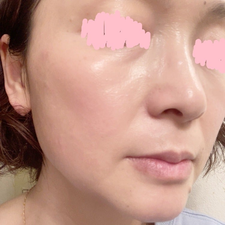 chiyo36 on LIPS 「今年2月の新作!気になってたクッションファンデ👇【NARS ラ..」(6枚目)