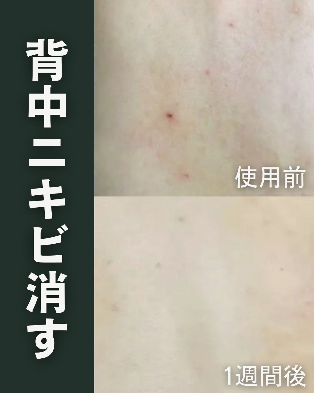 ロゼット スキンコンディショナーｉ/ロゼット/化粧水を使ったクチコミ（1枚目）