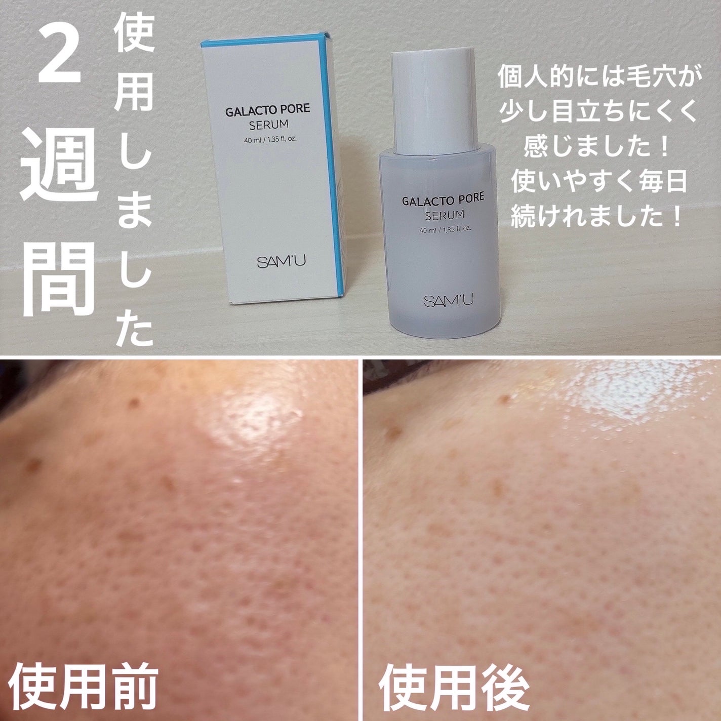 サミュ ガラクトポア セラム/SAM'U/美容液を使ったクチコミ(3枚目)
