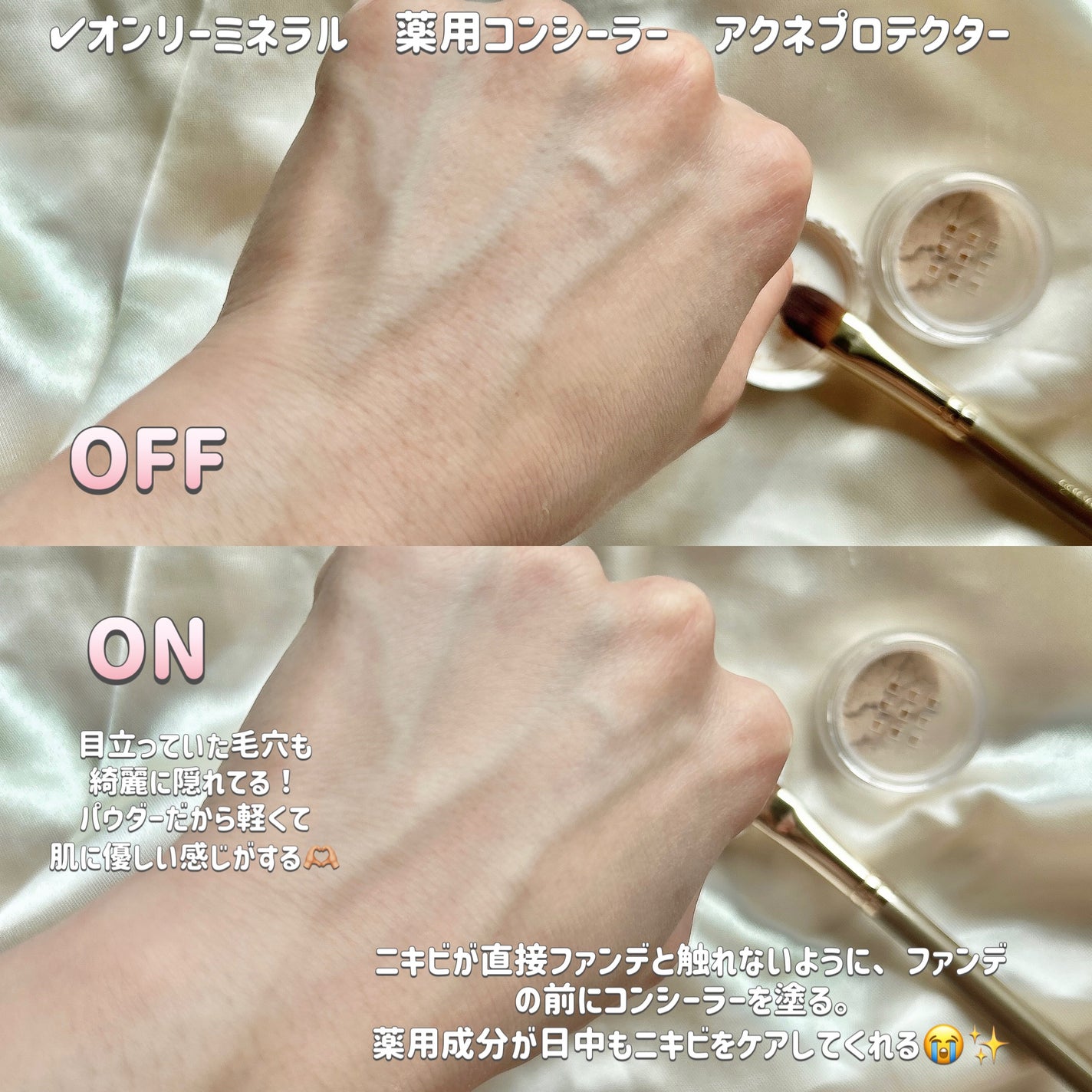 薬用コンシーラー アクネプロテクター/ONLY MINERALS/パウダーコンシーラーを使ったクチコミ(2枚目)