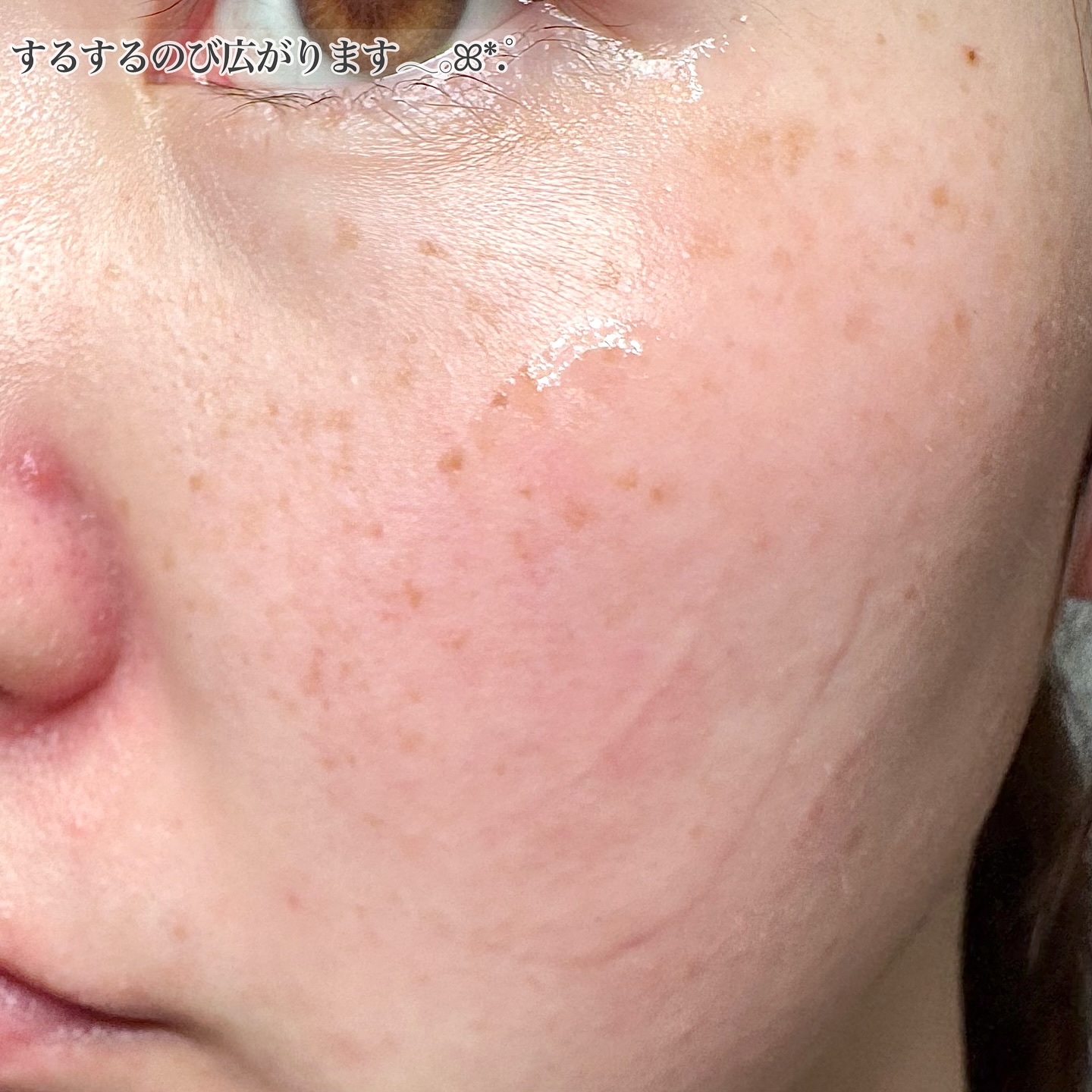 ナノインフィルトセラムLP/EXOLABEL/美容液を使ったクチコミ（3枚目）