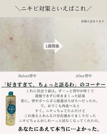 ロゼット スキンコンディショナーi/ロゼット/化粧水を使ったクチコミ(5枚目)