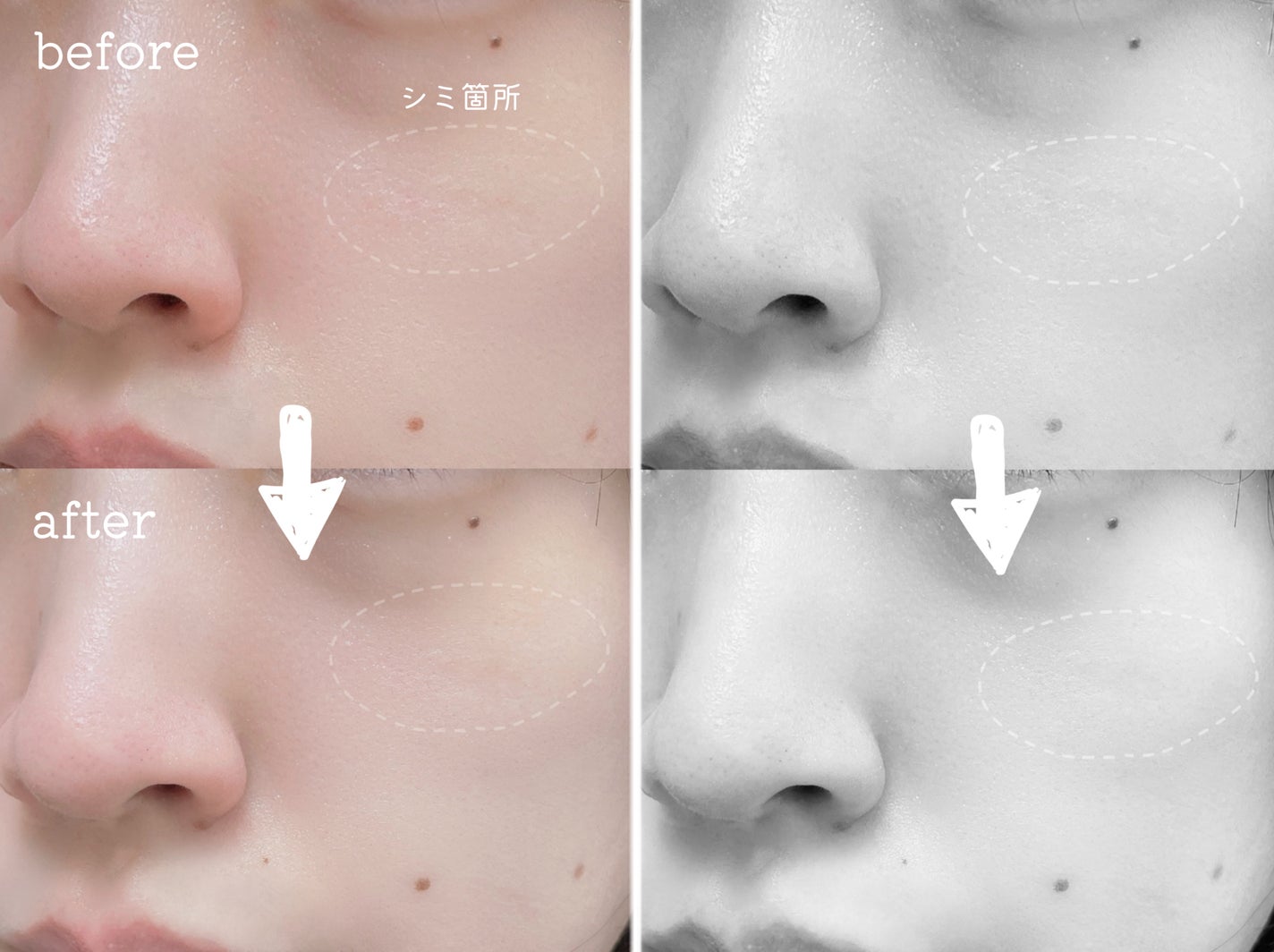 5番 白玉グルタチオンC美容液/numbuzin/美容液を使ったクチコミ(2枚目)