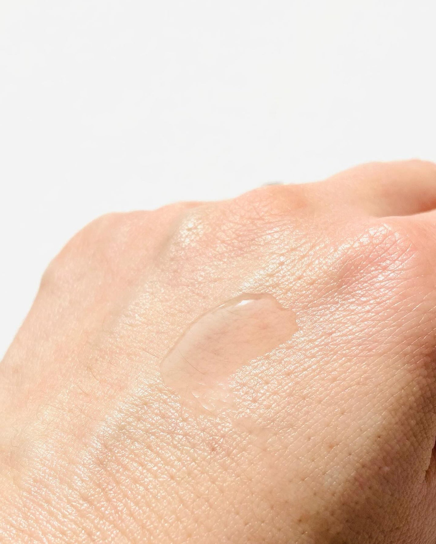 タカミスキンピール/タカミ/ブースター・導入液を使ったクチコミ(4枚目)