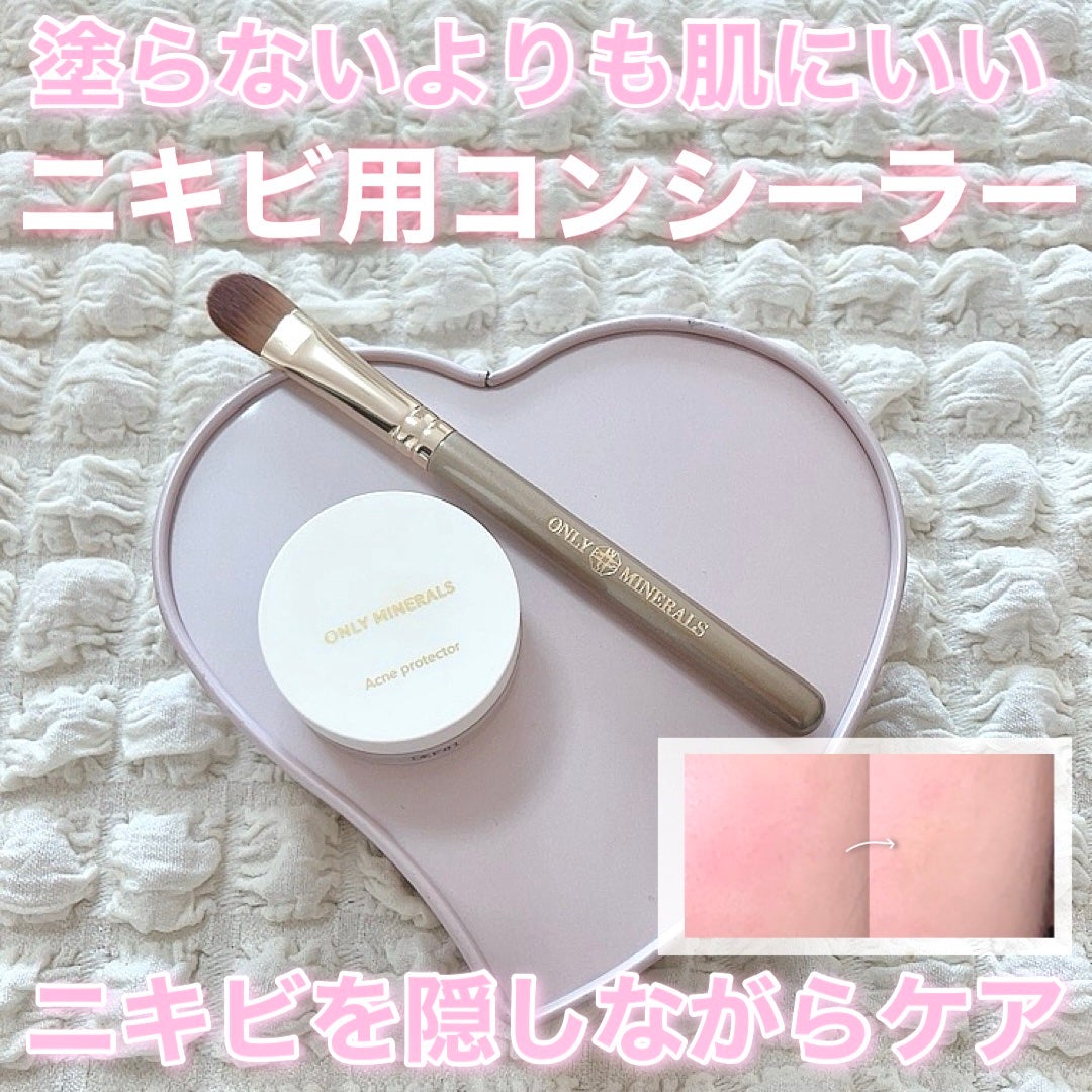 薬用コンシーラー アクネプロテクター/ONLY MINERALS/パウダーコンシーラーを使ったクチコミ(1枚目)