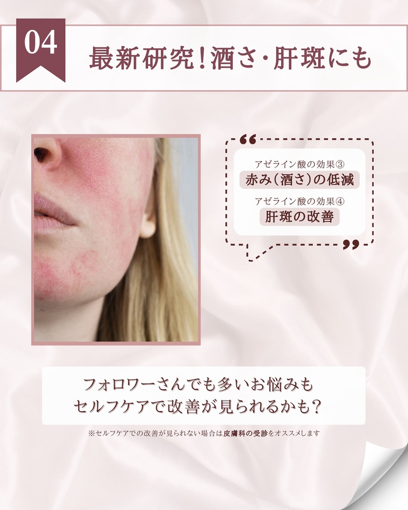 キソ バランシングクリームAZ/KISO/フェイスクリームを使ったクチコミ(6枚目)