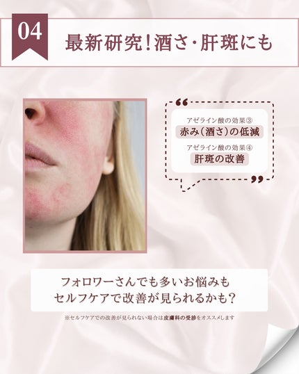 キソ バランシングクリームAZ/KISO/フェイスクリームを使ったクチコミ(6枚目)