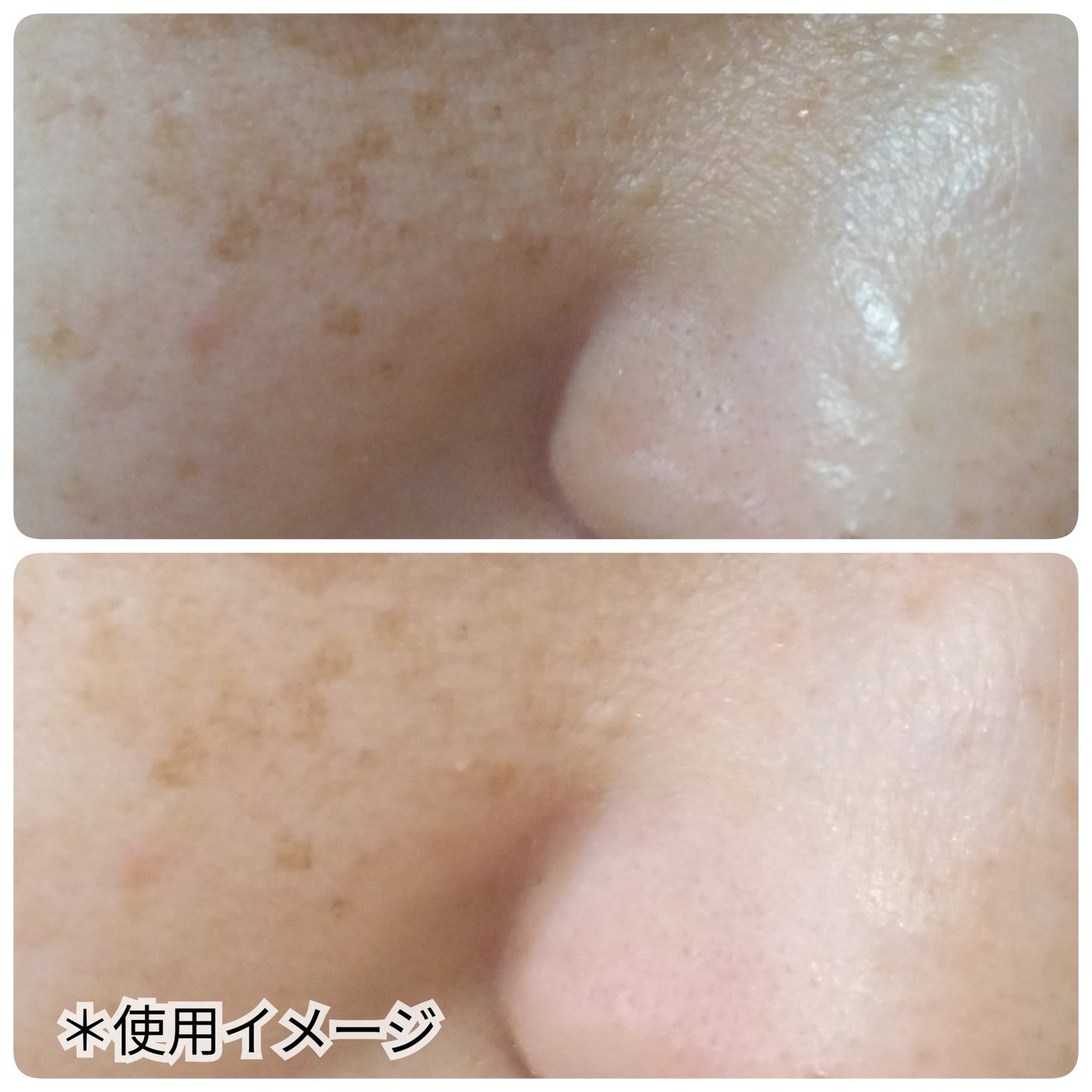 サミュ ガラクトポア セラム/SAM'U/美容液を使ったクチコミ(5枚目)