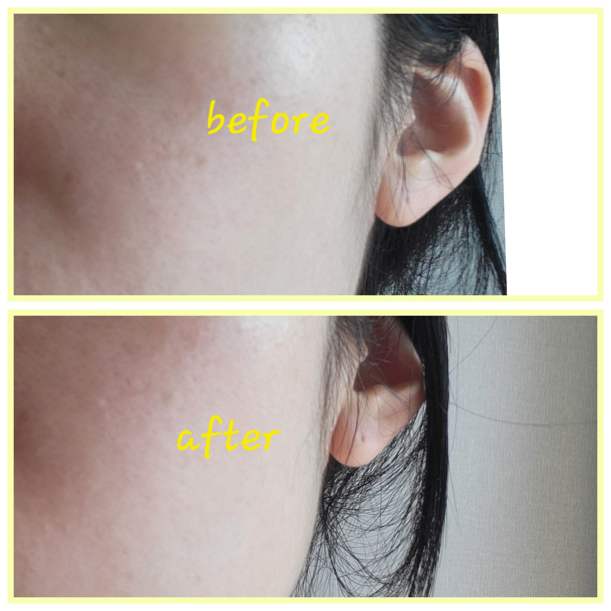 グルタチオンショットB3シミ跡セラム/It's skin/美容液を使ったクチコミ（3枚目）