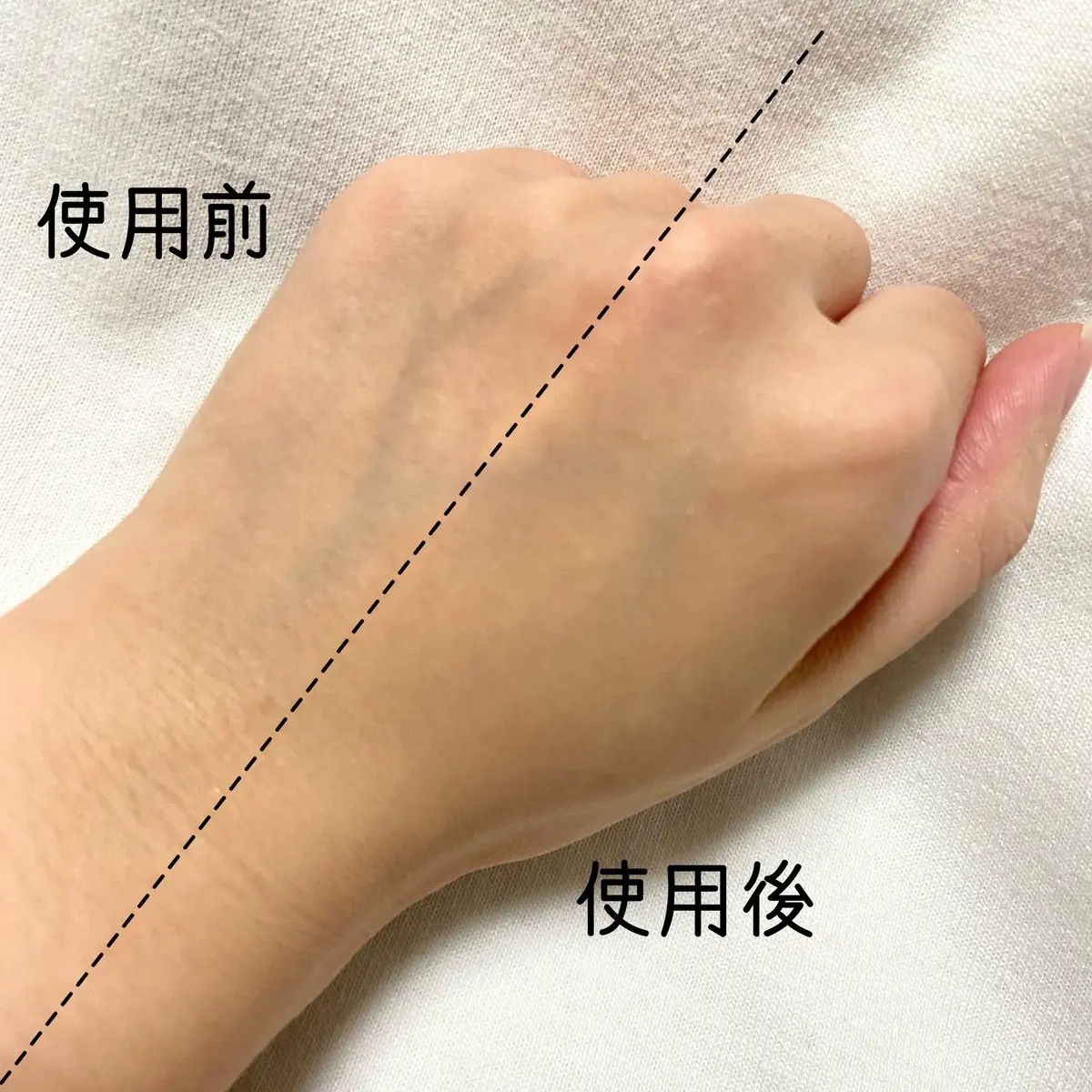 薬用コンシーラー アクネプロテクター/ONLY MINERALS/パウダーコンシーラーを使ったクチコミ（3枚目）