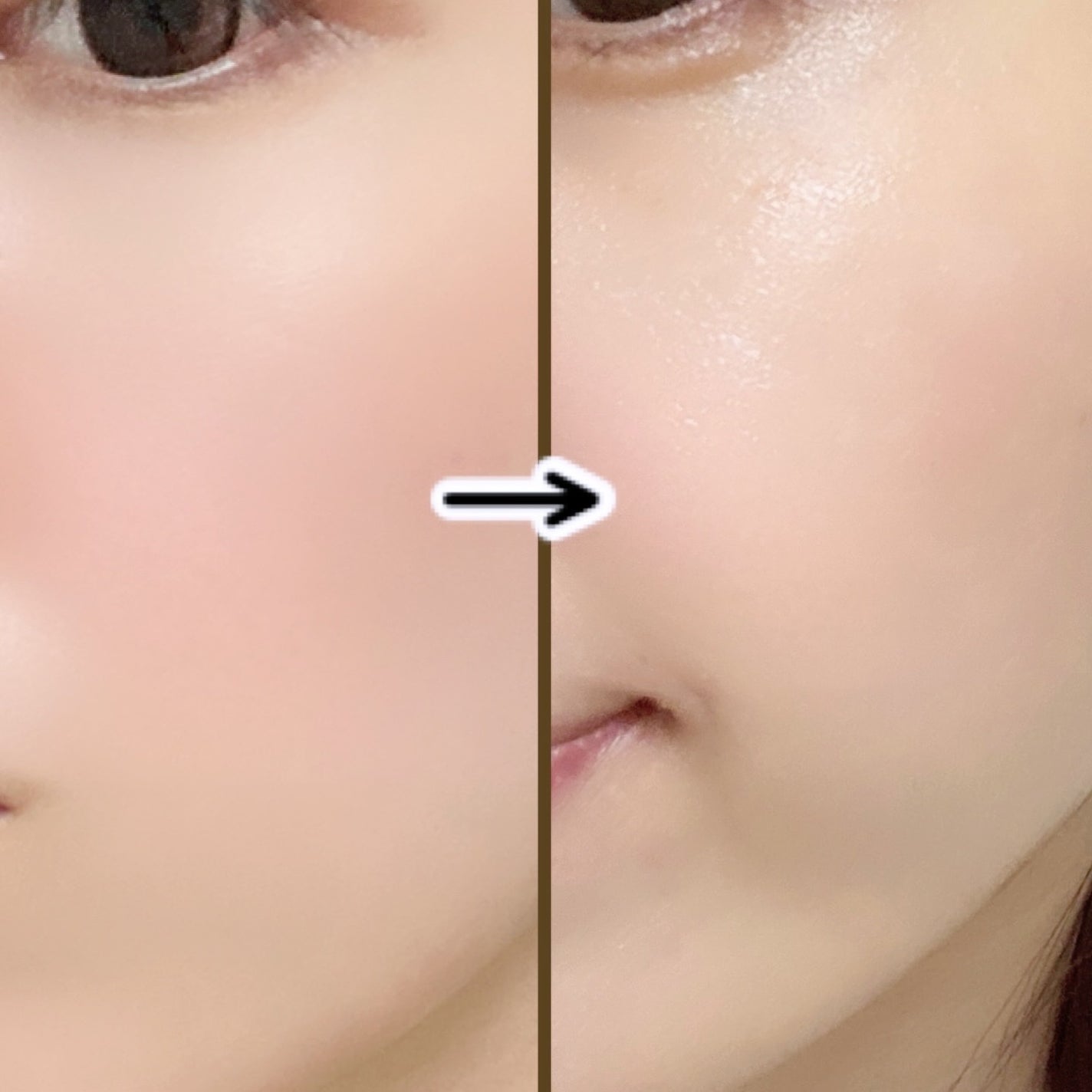 青麦ファーストLHAトナーパッド/Veganifect/トナーパッドを使ったクチコミ(5枚目)