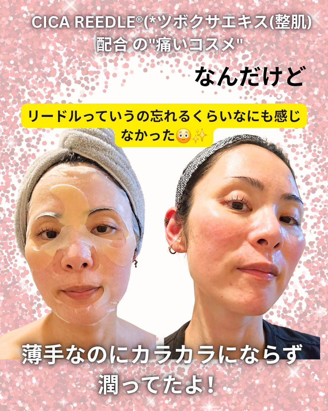 A1カーミング アンプル/VT/美容液を使ったクチコミ（2枚目）