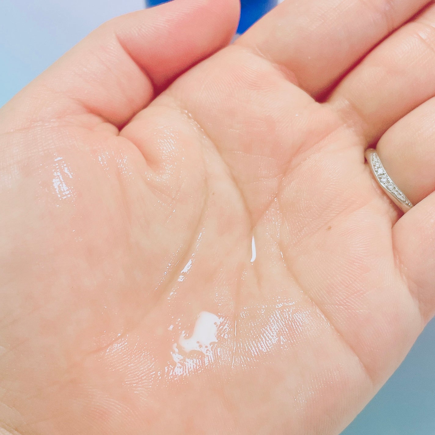 タカミスキンピール/タカミ/ブースター・導入液を使ったクチコミ(6枚目)