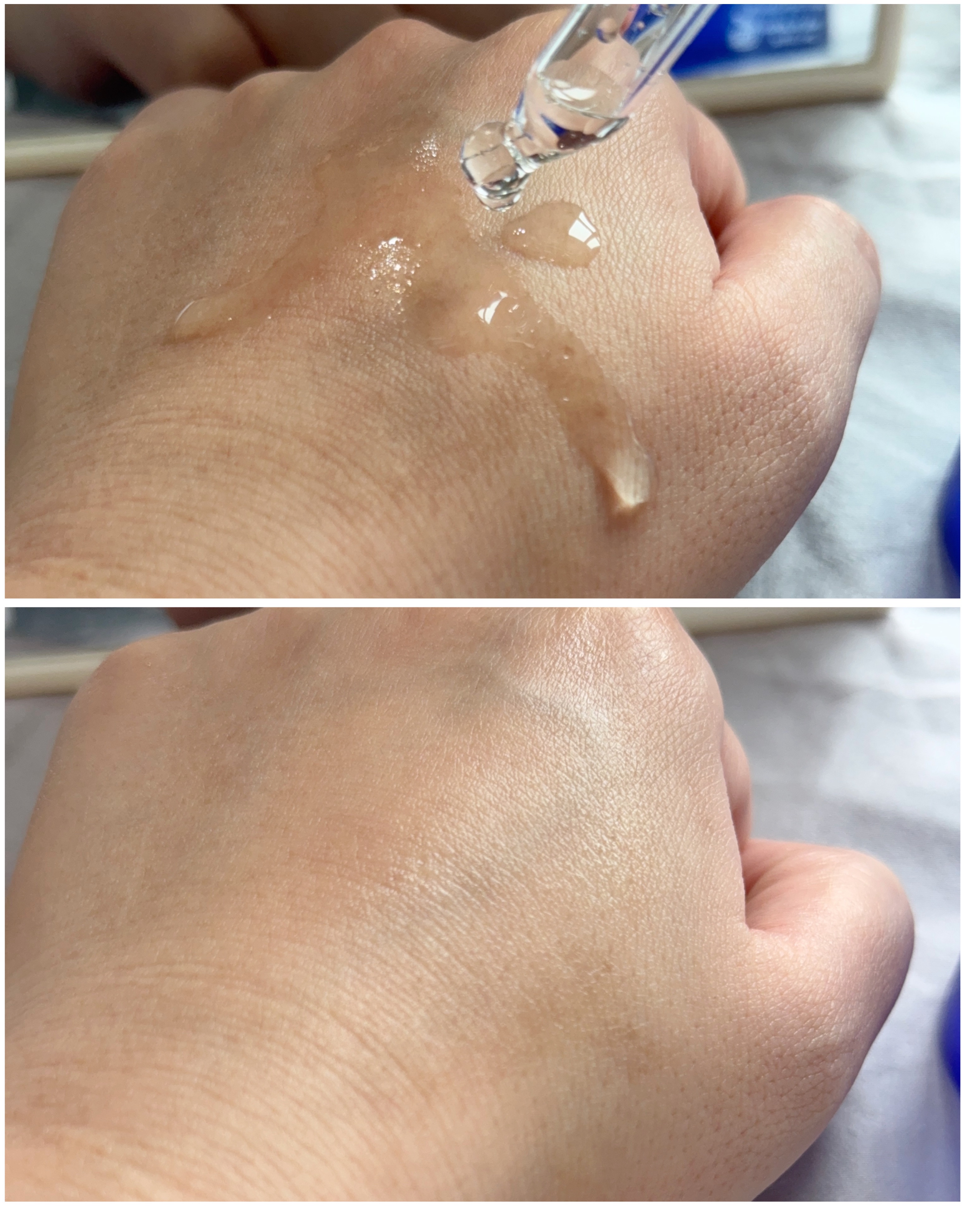 タカミスキンピール/タカミ/ブースター・導入液を使ったクチコミ（2枚目）