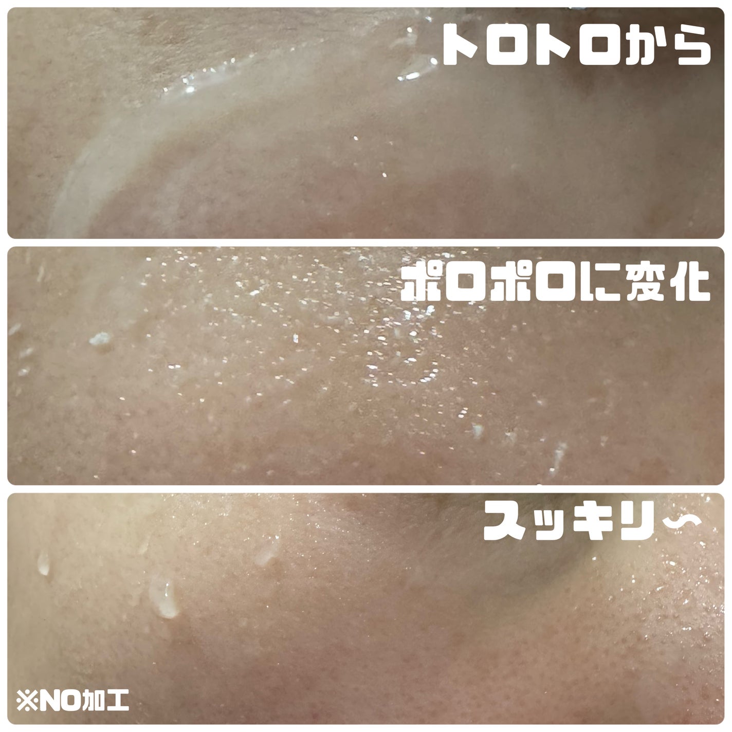 ☆scallop☆フォロバ100%☆ on LIPS 「\週末の肌リセットに!/【薬用GG角質クリアケアジェル】が、ま..」(4枚目)