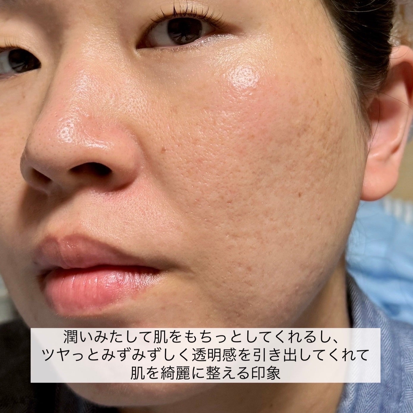 オイデルミン エッセンスローション/SHISEIDO/化粧水を使ったクチコミ(5枚目)