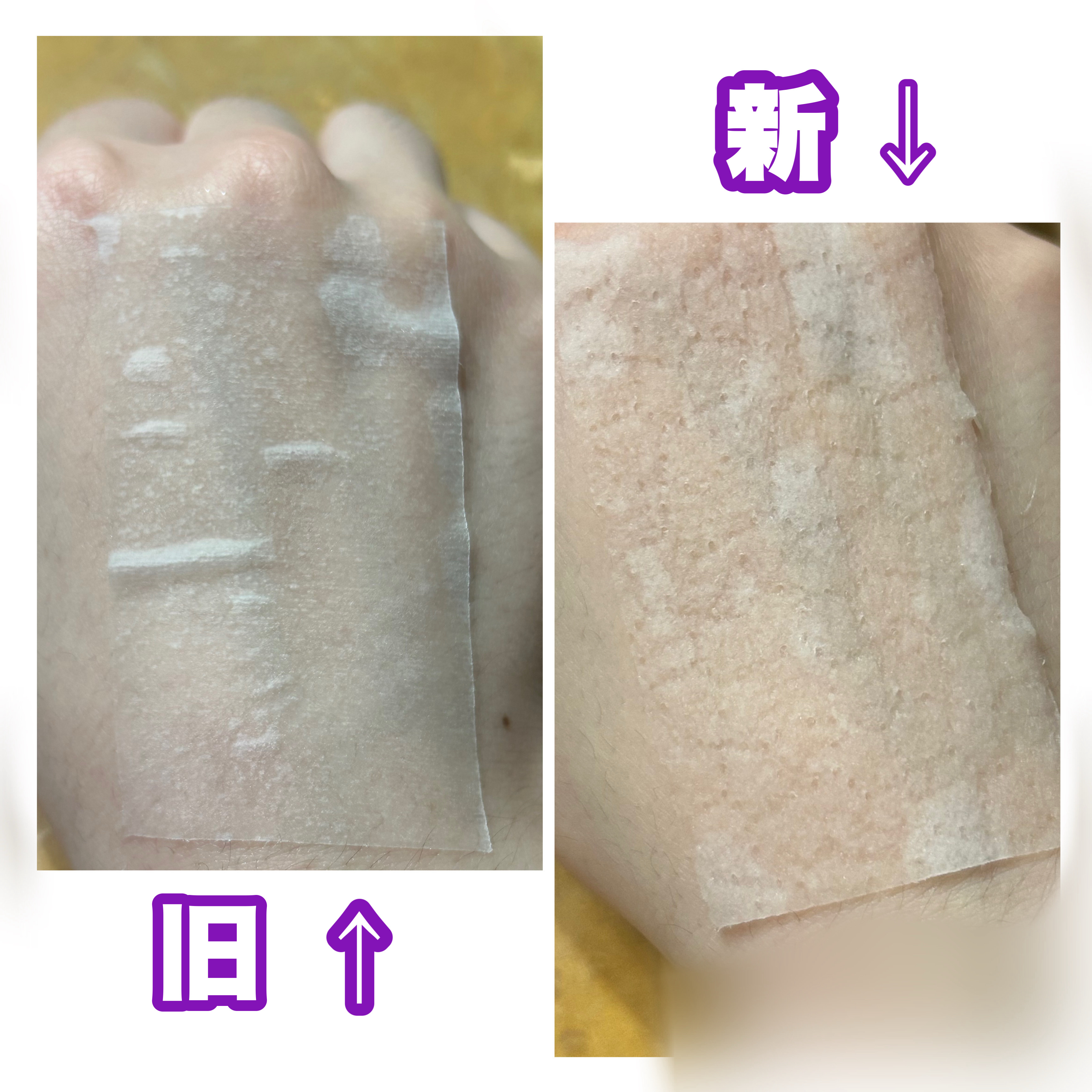 プロバイオダーム™ コラーゲンリモデリングセラムパッド/BIOHEAL BOH/シートマスク・パックを使ったクチコミ（3枚目）