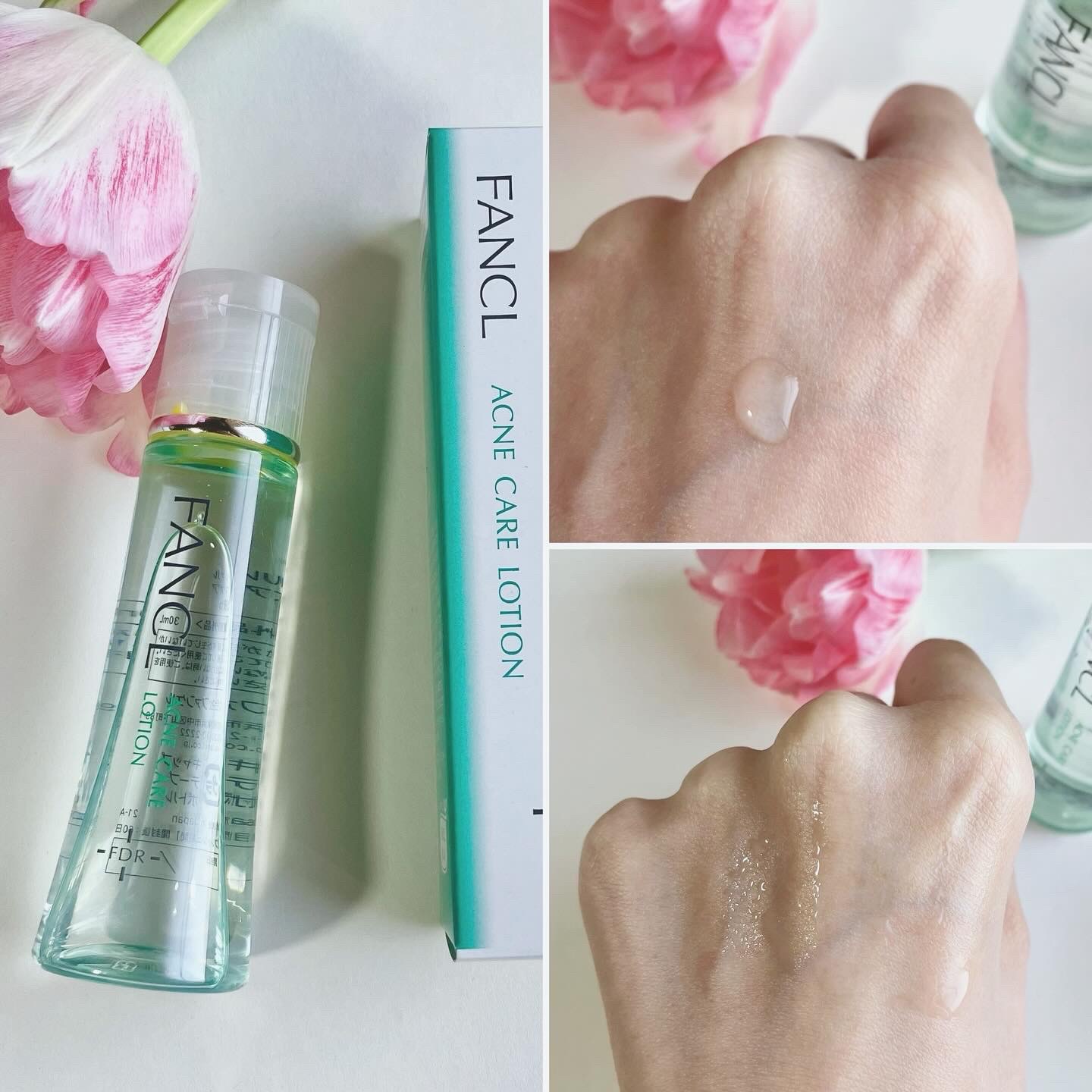 アクネケア ジェル乳液　＜医薬部外品＞/ファンケル/乳液を使ったクチコミ（2枚目）