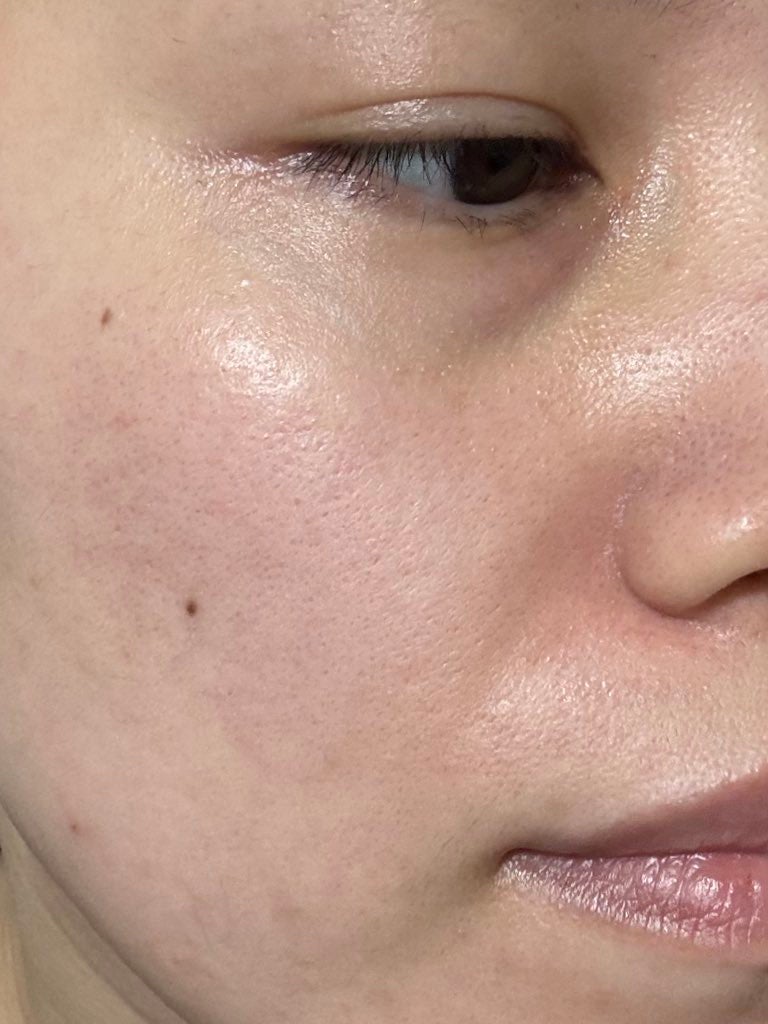 レッドブレミッシュ クイックトーニングTXAマスク/Dr.G/シートマスク・パックを使ったクチコミ(4枚目)