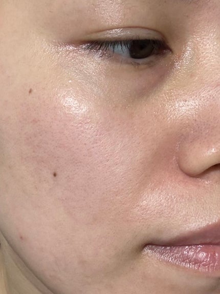 レッドブレミッシュ クイックトーニングTXAマスク/Dr.G/シートマスク・パックを使ったクチコミ(4枚目)