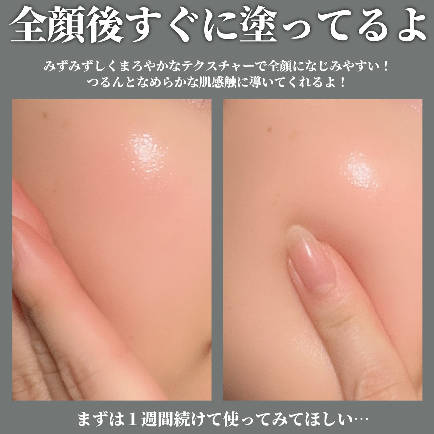 ポーラ リンクルショット メディカル セラム デュオ/リンクルショット/美容液を使ったクチコミ(4枚目)