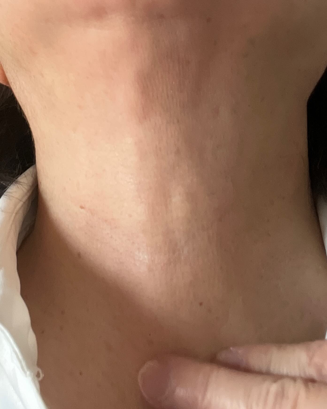 ハリーハリー 薬用おとなの美くびクリーム リッチ（医薬部外品）/ハリーハリー/ネック・デコルテケアを使ったクチコミ（3枚目）