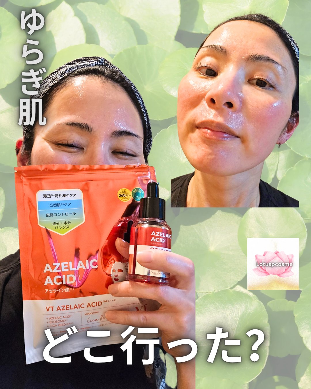 A1カーミング アンプル/VT/美容液を使ったクチコミ（1枚目）