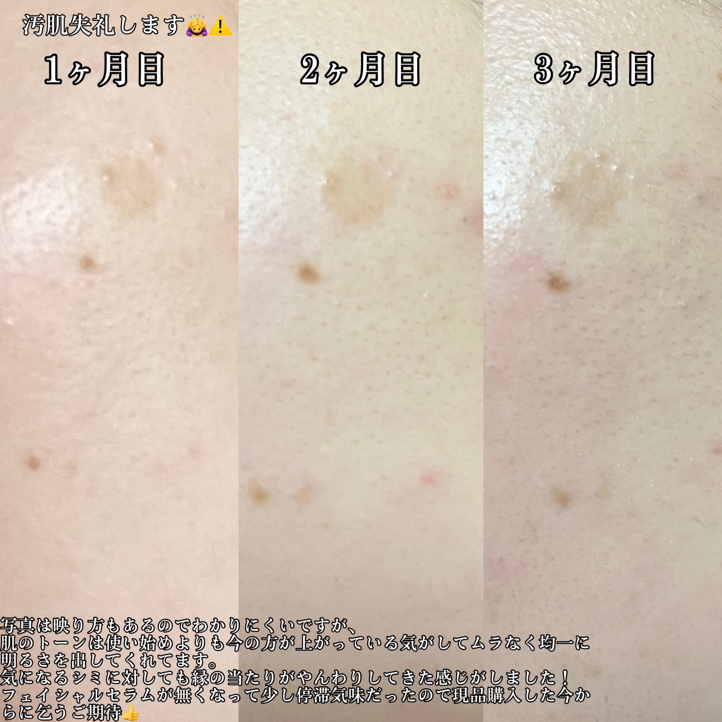 ホワイトショット SXS/ホワイトショット/美容液を使ったクチコミ(4枚目)