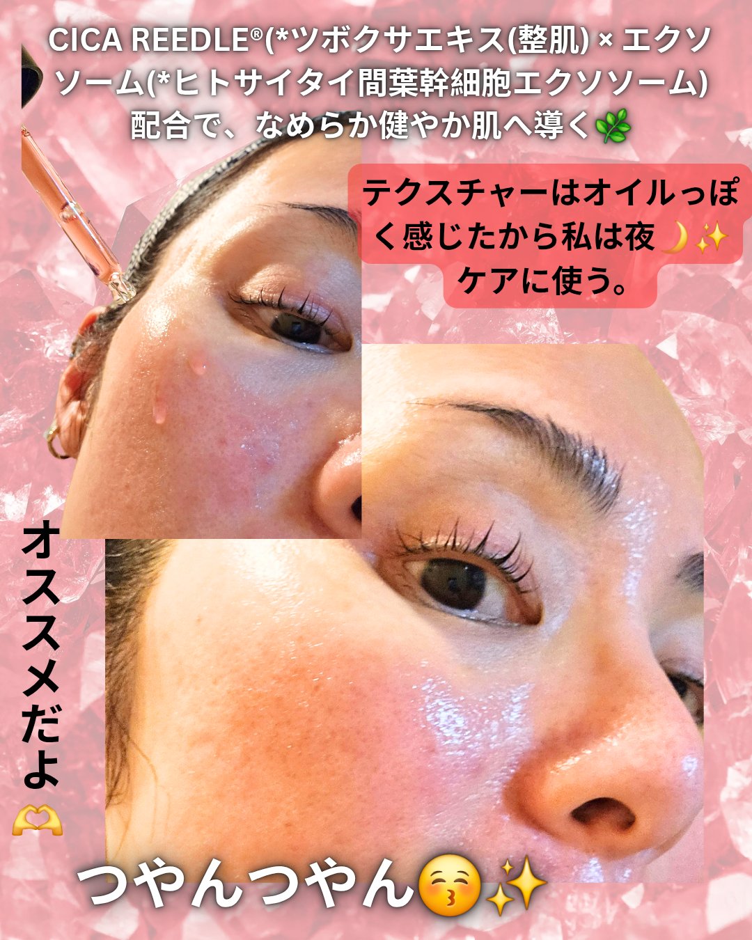 A1カーミング アンプル/VT/美容液を使ったクチコミ（3枚目）