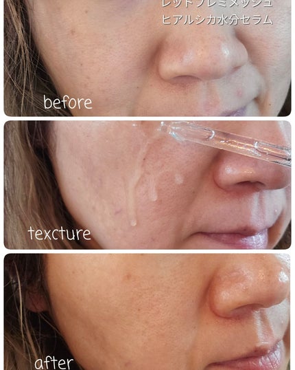 レッドブレミッシュ クリアスージングクリーム/Dr.G/フェイスクリームを使ったクチコミ(4枚目)