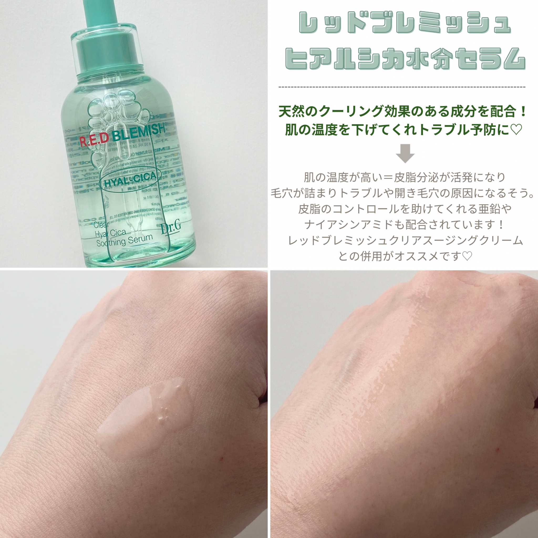 レッドブレミッシュ クリアスージングクリーム/Dr.G/フェイスクリームを使ったクチコミ（2枚目）