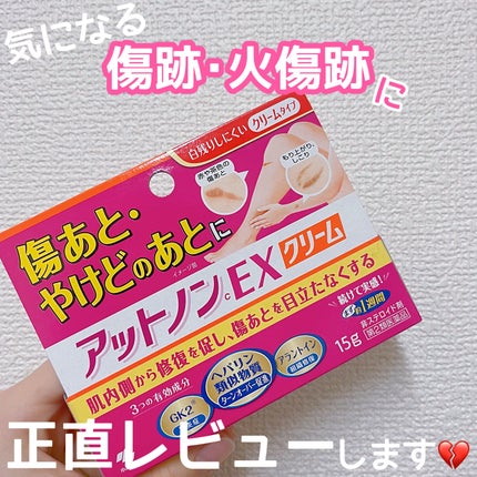 アットノンEX クリーム(医薬品)/アットノン/その他を使ったクチコミ(1枚目)