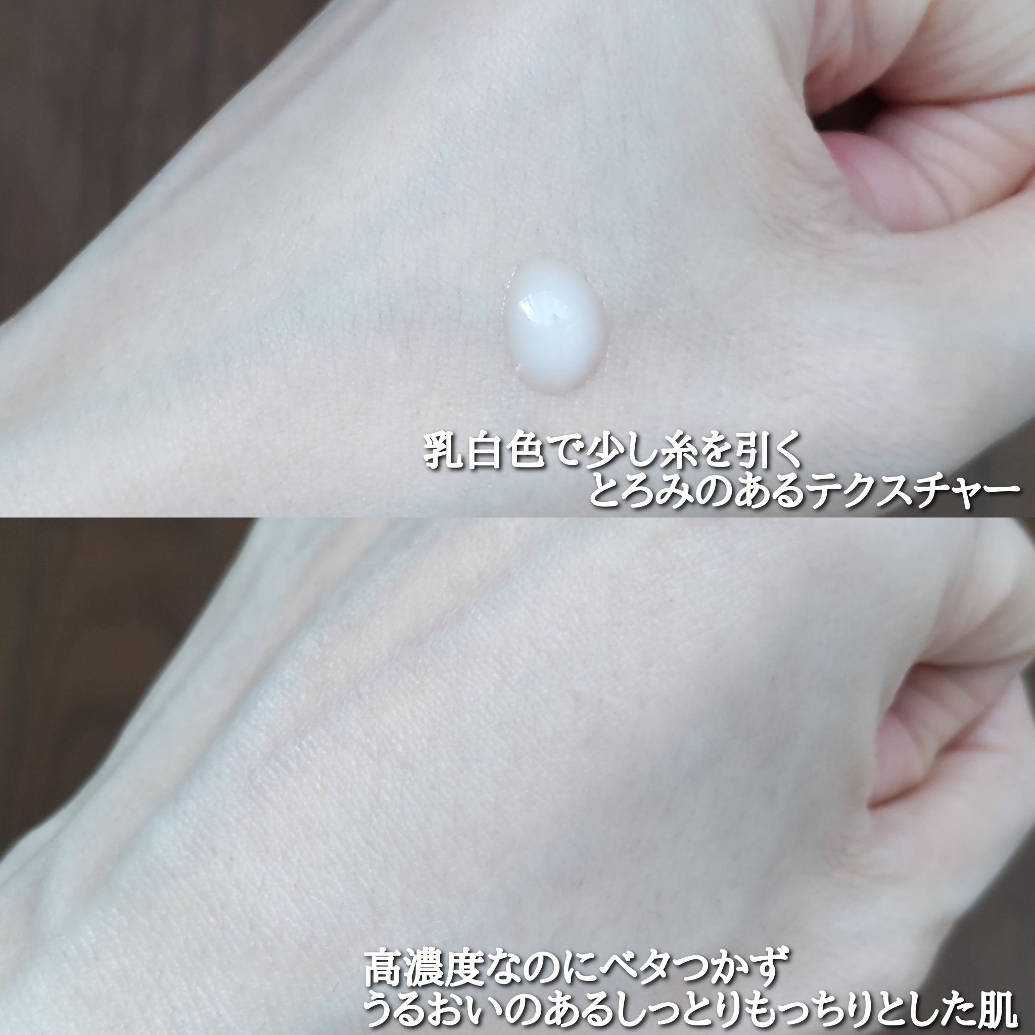 センテラ クイックカーミングパッド/SKIN1004/トナーパッドを使ったクチコミ（3枚目）