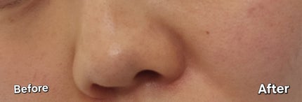 グルタチオンショットB3シミ跡セラム/It's skin/美容液を使ったクチコミ(3枚目)